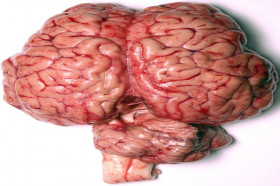 What Percentage Of The Human Brain Do We Use?